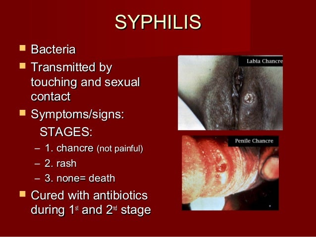 signs of sexual transmitted Michelle bombshell mcgee porn video